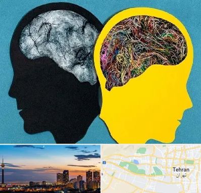 دکتر اختلال دوقطبی در غرب تهران 