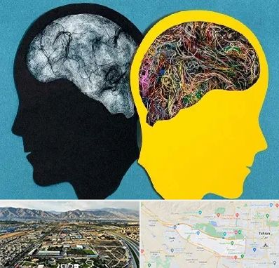 دکتر اختلال دوقطبی در منطقه 21 تهران 