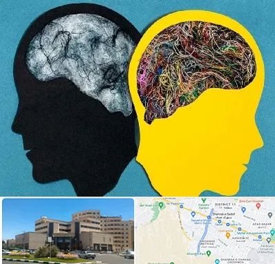 دکتر اختلال دوقطبی در صیاد شیرازی مشهد 