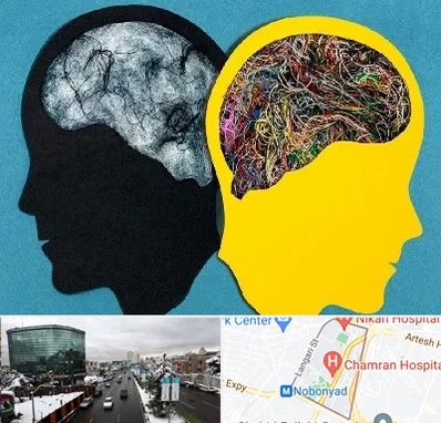 دکتر اختلال دوقطبی در اقدسیه 