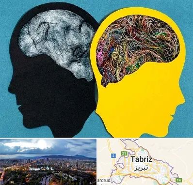 دکتر اختلال دوقطبی در تبریز