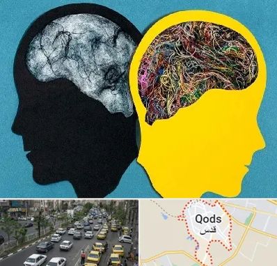 دکتر اختلال دوقطبی در شهر قدس