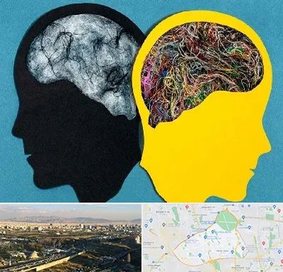 دکتر اختلال دوقطبی در منطقه 19 تهران 