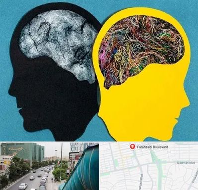 دکتر اختلال دوقطبی در بلوار فرحزادی