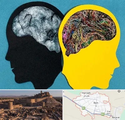 دکتر اختلال دوقطبی در بم