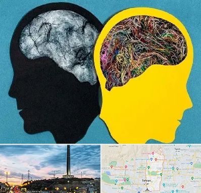 دکتر اختلال دوقطبی در منطقه 2 تهران 