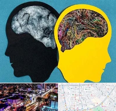 دکتر اختلال دوقطبی در منظریه رشت 