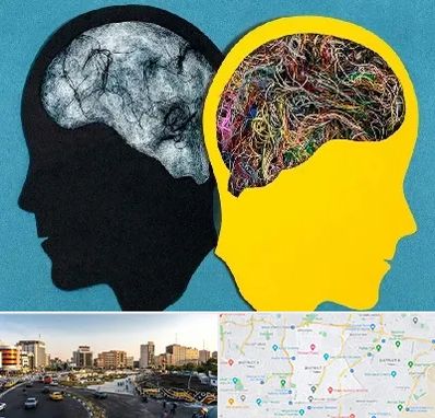 دکتر اختلال دوقطبی در منطقه 7 تهران 