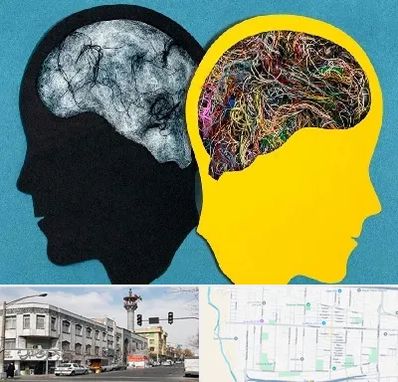 دکتر اختلال دوقطبی در 17شهریور