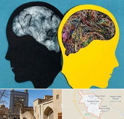 دکتر اختلال دوقطبی در تربت جام
