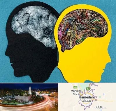 دکتر اختلال دوقطبی در همدان