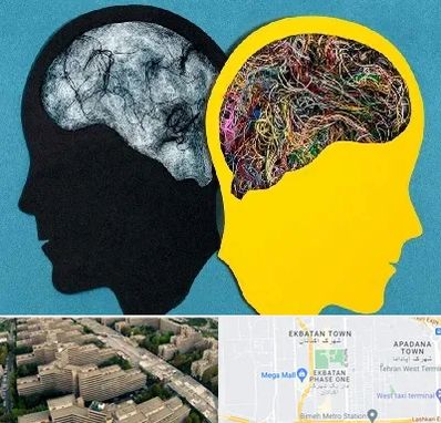 دکتر اختلال دوقطبی در اکباتان 