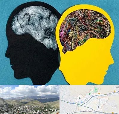 دکتر اختلال دوقطبی در رودهن