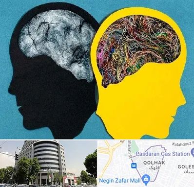 دکتر اختلال دوقطبی در قلهک 