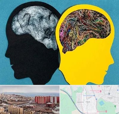 دکتر اختلال دوقطبی در سهند تبریز 