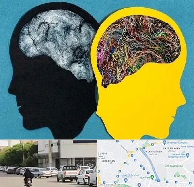 دکتر اختلال دوقطبی در قدوسی شرقی شیراز 