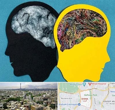 دکتر اختلال دوقطبی در گیشا 