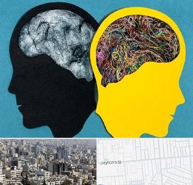 دکتر اختلال دوقطبی در جیحون