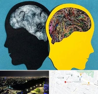 دکتر اختلال دوقطبی در هفت تیر مشهد 