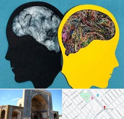 دکتر اختلال دوقطبی در مصلی مشهد 