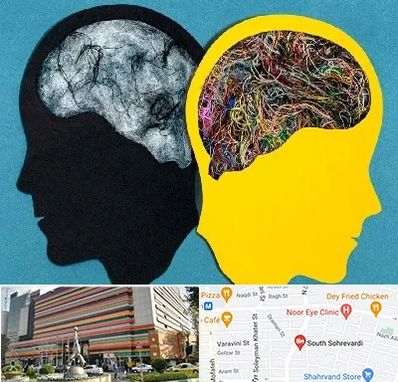 دکتر اختلال دوقطبی در سهروردی 