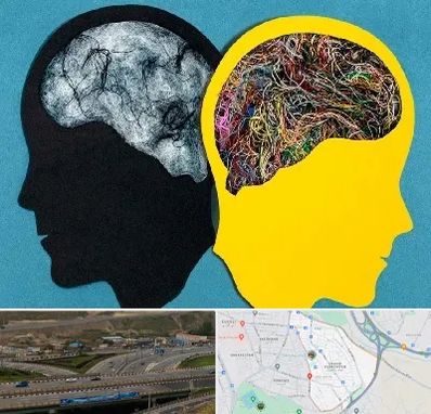 دکتر اختلال دوقطبی در یاغچیان تبریز 