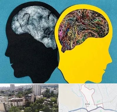 دکتر اختلال دوقطبی در اوین