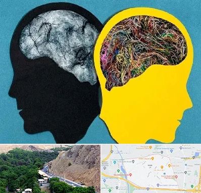 دکتر اختلال دوقطبی در کن 