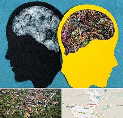 دکتر اختلال دوقطبی در دماوند