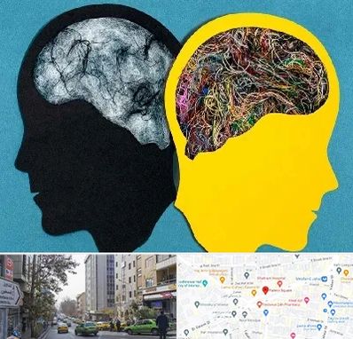 دکتر اختلال دوقطبی در فاطمی 