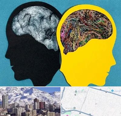 دکتر اختلال دوقطبی در ازگل