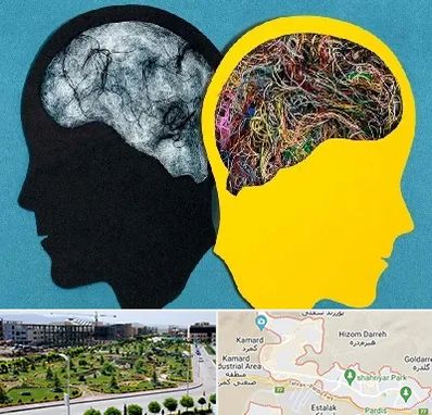 دکتر اختلال دوقطبی در پردیس