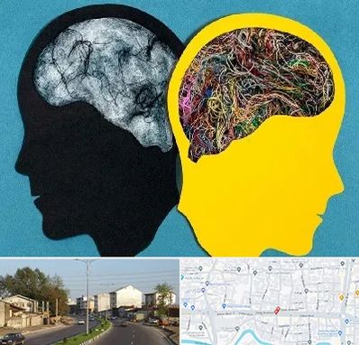 دکتر اختلال دوقطبی در ضیابری رشت 