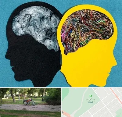 دکتر اختلال دوقطبی در مشیریه