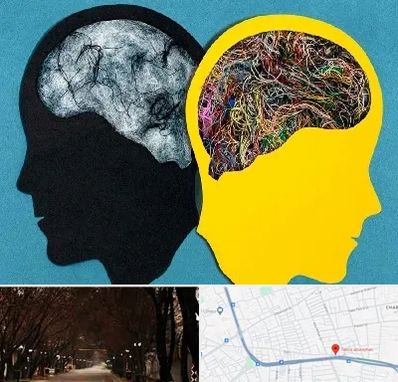 دکتر اختلال دوقطبی در ابوریحان تبریز 