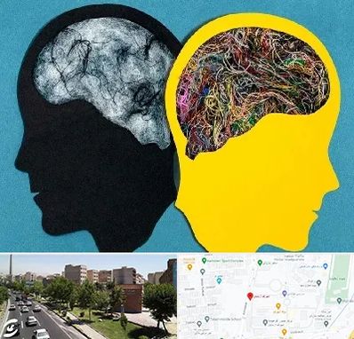 دکتر اختلال دوقطبی در شهرک آزمایش 