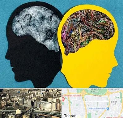 دکتر اختلال دوقطبی در مرزداران 