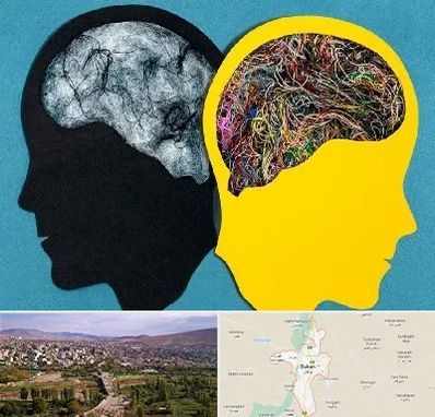 دکتر اختلال دوقطبی در بوکان