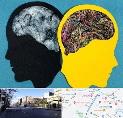 دکتر اختلال دوقطبی در خیابان ملاصدرا شیراز 