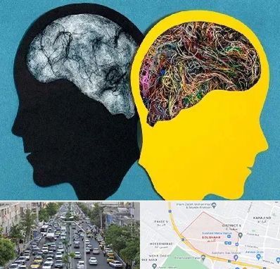 دکتر اختلال دوقطبی در گلشهر کرج 