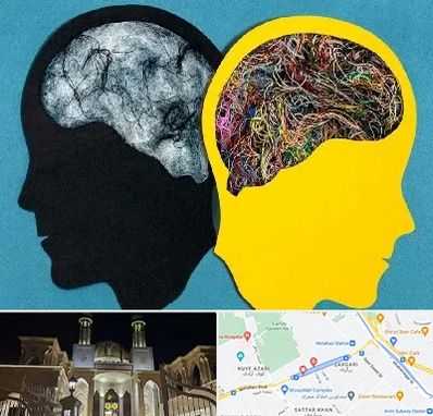 دکتر اختلال دوقطبی در زرگری شیراز 