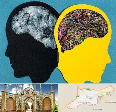 دکتر اختلال دوقطبی در سمنان