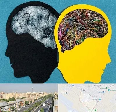 دکتر اختلال دوقطبی در کیانمهر کرج 