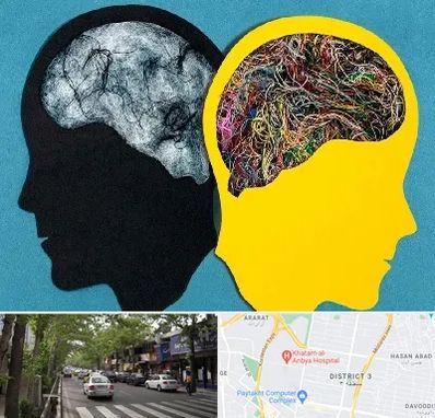 دکتر اختلال دوقطبی در ظفر 