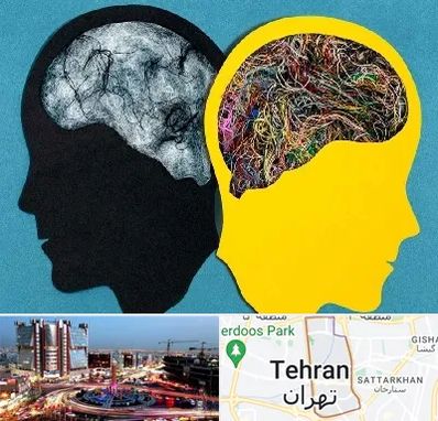 دکتر اختلال دوقطبی در صادقیه 