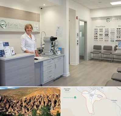 بینایی سنجی در اسکو