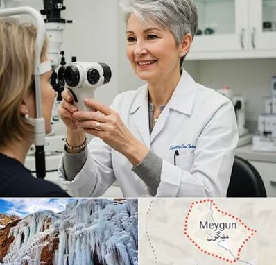 اپتومتریست در میگون