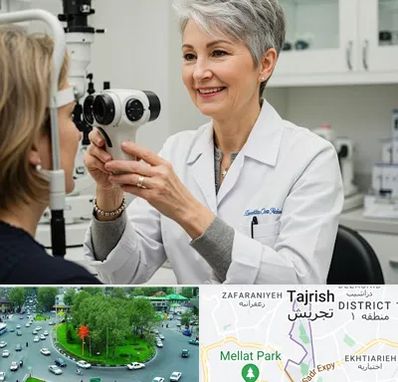 اپتومتریست در تجریش 