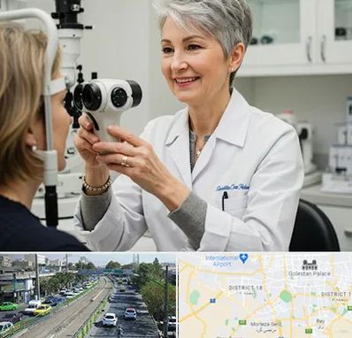 اپتومتریست در جنوب تهران 