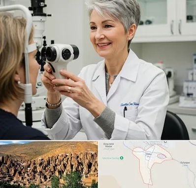 اپتومتریست در اسکو